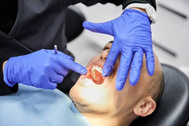 Best Knocked-Out Tooth (Avulsed Tooth) Treatment in Satellite Beach, FL
